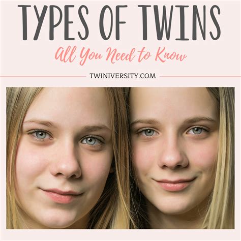 what type of twins conjoined twins are most similar to